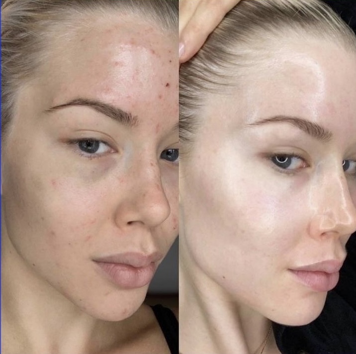 کرم جوانساز اسپرم ماهی سالمون